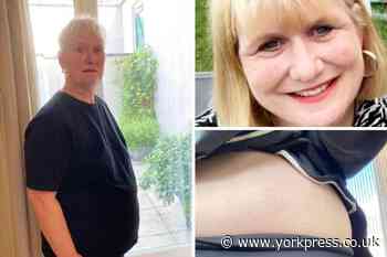 York: Sarah Mason, 51, says IBS leaves her looking pregnant