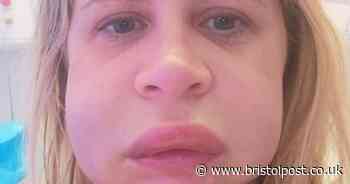 Mum 'permanently disfigured' after dentist visit sees face 'balloon'
