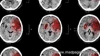Late-Window Tenecteplase for Stroke Works When Thrombectomy's Out of the Question
