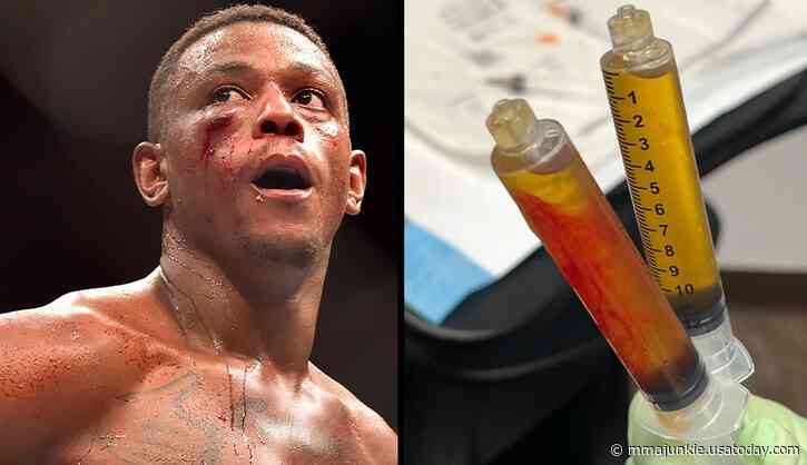 Jamahal Hill reveals list of injuries behind UFC 303 withdrawal, vows to 'be back soon'