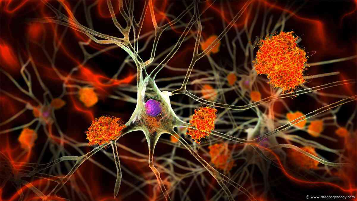 Alzheimer's Risk Higher If Mom Had Memory Problems