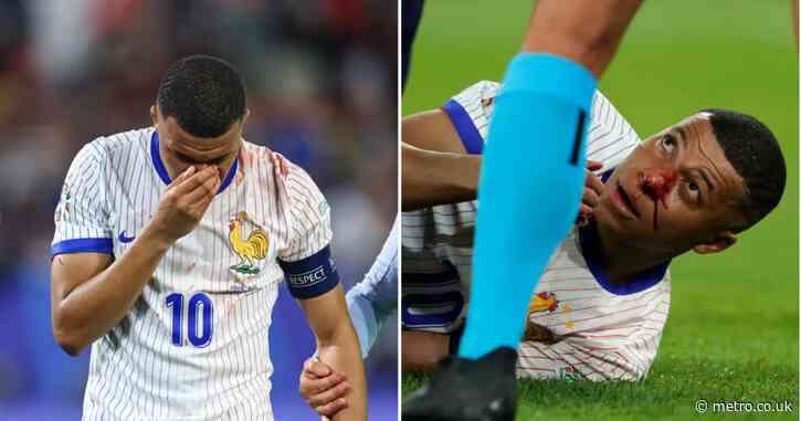 Kylian Mbappe leaves pitch with broken nose and bloody shirt as France beat Austria at Euro 2024