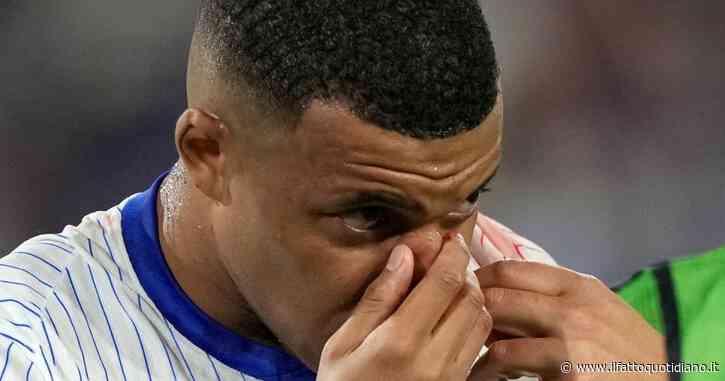 Euro 2024, la Francia trema: Kylian Mbappé si è rotto il naso. Le sue condizioni e quando può tornare in campo