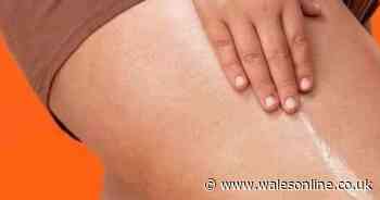 Body oil hailed as 'magic' for reducing appearance of scars and stretch marks now only £10