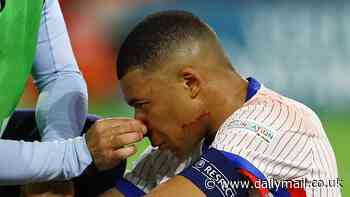 Kylian Mbappe 'set to MISS a chunk of Euro 2024' with his broken nose stopping him from playing, new report in France reveals... but it might not help England's chances