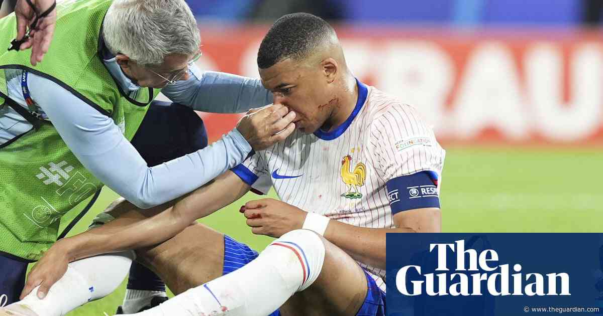 Kylian Mbappé could miss rest of Euro 2024 group stage due to broken nose
