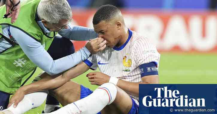 Kylian Mbappé could miss rest of Euro 2024 group stage due to broken nose