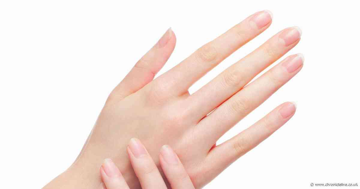 Three signs in your hands that could mean you have serious health issues including cancer