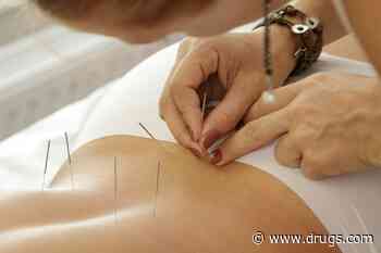 Acupuncture Can Ease Side Effects of Breast Cancer Treatment