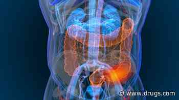 PIK3CA Could Guide Use of COX-2 Inhibitors in Treatment for Colon Cancer