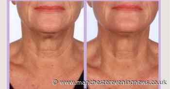 Beauty buffs hail Marks and Spencer's anti-wrinkle oil for sagging necks after 'unbelievable' results