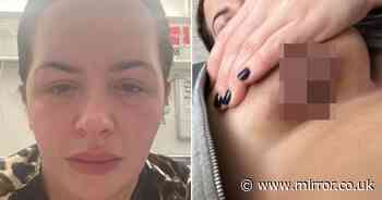 Devastated mum left with 'leaking black breasts' when Turkey boob job goes wrong