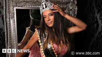 Heart surgery scar 'is who I am', pageant contestant says