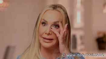 Shannon Beador shows shock snap of her bloodied face after DUI accident in harrowing Real Housewives of Orange County promo