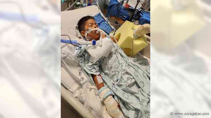 Boy, 10, loses 3 fingers after a firework explodes in his hand in San Juan Capistrano