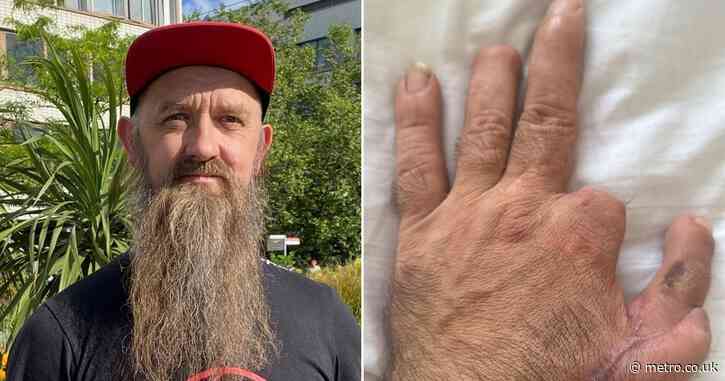 Dad who accidentally sawed his fingers off returns to carpentry after transplant