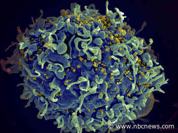 A 7th person with HIV is probably cured after stem cell transplant for leukemia, scientists say