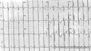 ECG Challenge: New Beats with a Pacemaker