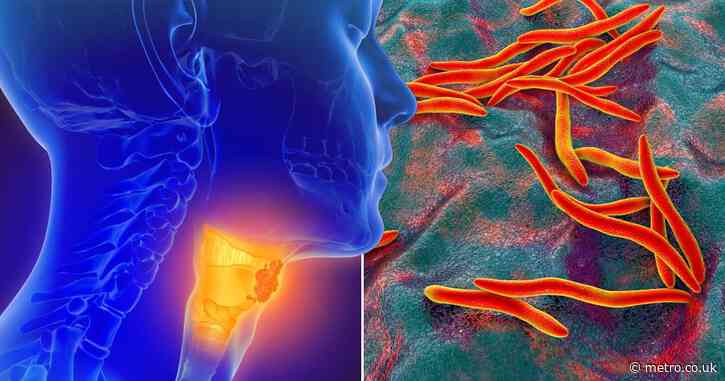 Common mouth bacteria can ‘melt’ away cancer cells, scientists say