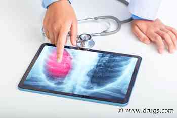 Rheumatoid Arthritis Tied to Higher Risk for Lung Cancer