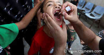 Large-scale polio vaccination campaign begins in Gaza