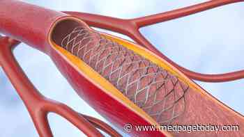 Balloon Angioplasty 'Lite' Improves Key Intracranial Stenosis Outcomes