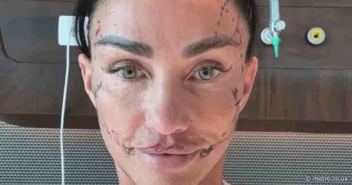 Katie Price urges fans to ‘trust the process’ by sharing shocking photos of facelift recovery