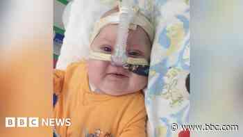 Doctors admit baby's brain damage was preventable