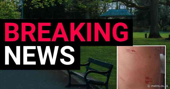 Girl, 4, mauled by two ‘XL Bullies’ while playing in park with mum