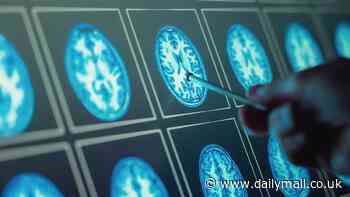 Lockdowns prematurely aged teenagers' brains by up to four years, study suggests