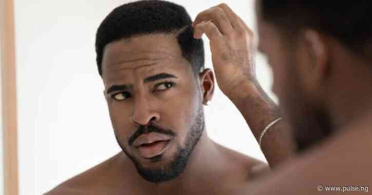 Stress and 5 other unexpected causes of dandruff