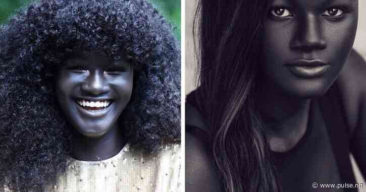 Why people living near the Equator have darker skin