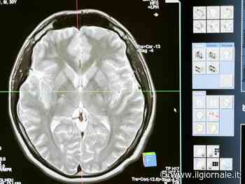 Una ricerca dimostra dove intervenire per la cura della schizofrenia