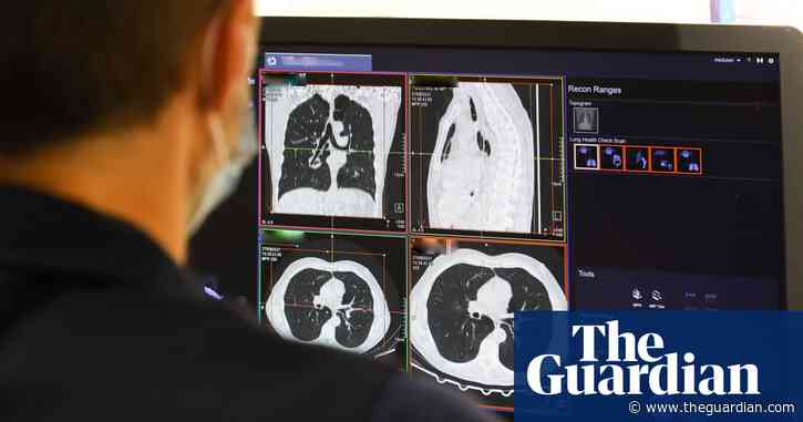 UK can expect ‘tsunami of missed cancers’ in wake of pandemic, experts say