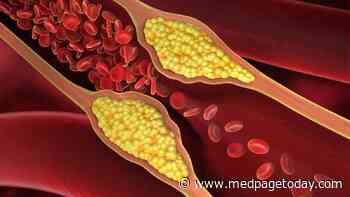 Metal Exposure Also Linked to More Coronary Artery Calcium