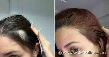 New hair serum 'doubled the amount of hair' for shoppers in five weeks