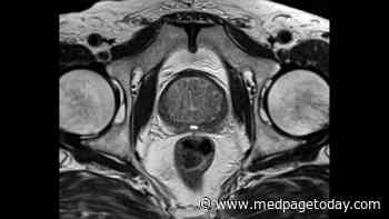 Omitting Biopsy After Negative MRI Halves Diagnoses of Insignificant Prostate Cancer