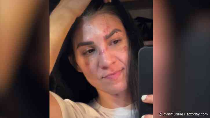 With stitches out, Irene Aldana shares healing progress on insane cuts suffered at UFC 306