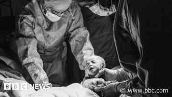 Childbirth experiences captured by photographer