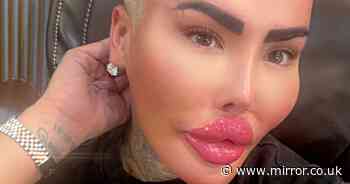 TV star dubbed 'The Lip King' made wild plastic surgery sex claim before BBL arrest