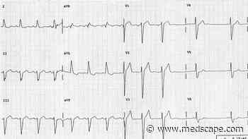 ECG Challenge: Irregular Pulse in a Hypertensive Patient