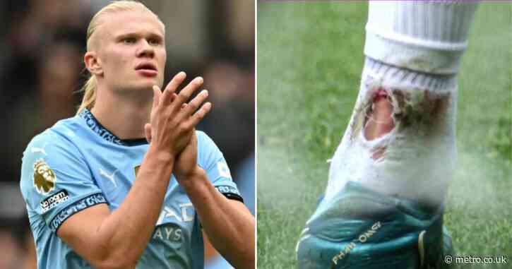 Pep Guardiola provides Erling Haaland injury update after Man City striker draws rare blank