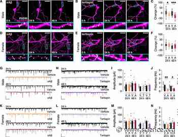 Amyloid-β oligomers trigger sex-dependent inhibition of GIRK channel activity in hippocampal neurons in mice | Science Signaling