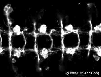 A human DCC variant causing mirror movement disorder reveals that the WAVE regulatory complex mediates axon guidance by netrin-1–DCC | Science Signaling