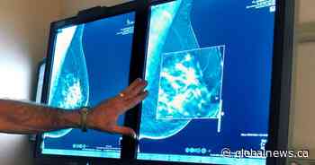 Breast cancer is rising among U.S. young women even as deaths drop: study