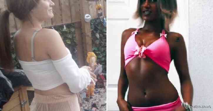 Teenager compared to a ‘burnt chip’ urges younger generations not to use sunbeds