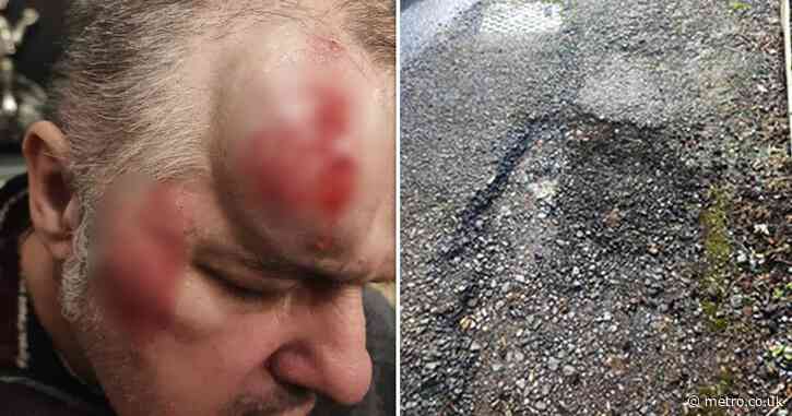 Grandad ‘broke spine and smashed face’ after tripping on gaping pothole