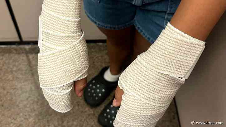 Texas middle schoolers suffer burns after 'punishment' from coach