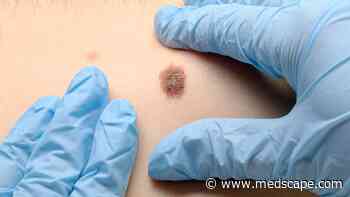 Study Finds Racial Differences in Second Primary Melanoma