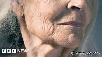 New skin research could help slow signs of ageing